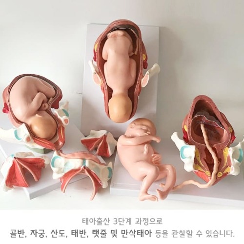 인체 태아출산 3단계 모형